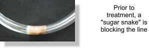 Prior to treatment, a "sugar snake" is blocking the line